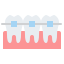 ceramic-braces